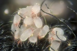 kenapa rumah cepat berhabuk - dust mites